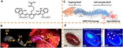 Recent Progresses in NIR-I/II Fluorescence Imaging for Surgical Navigation